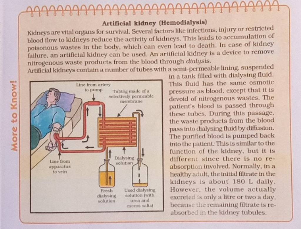 Artificial Kidncy Hemodialysis Kidneys Are Vital Organs For Survival S   1652674780599 Blkcxofw 1850076 