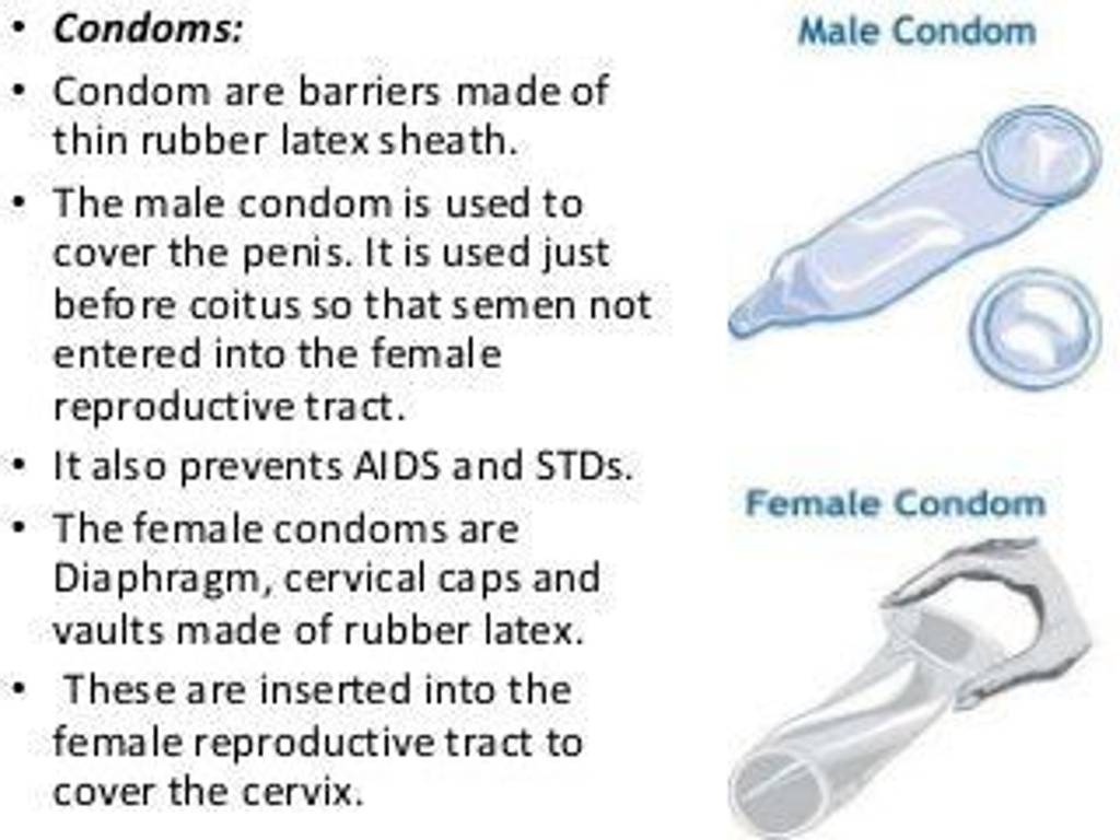 Condom Are Barriers Made Of Thin Rubber Latex Sheath Filo 5641