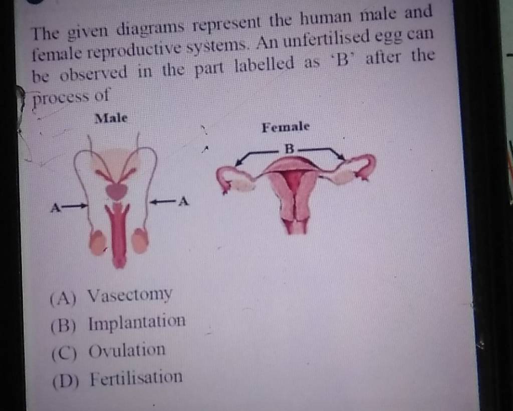 The given diagrams represent the human male and female reproductive syste..