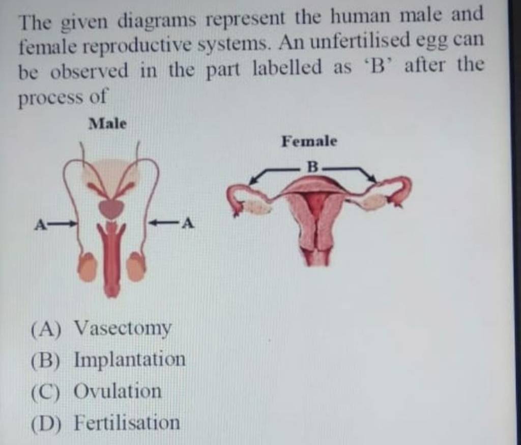 The given diagrams represent the human male and female reproductive syste..