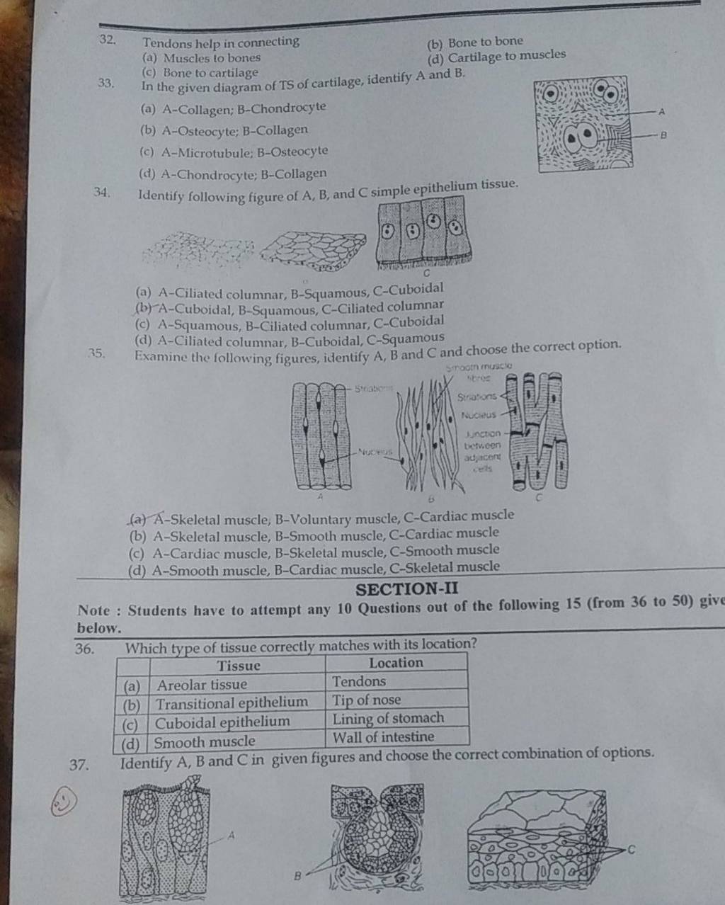 In the given diagram of TS of cartilage, identify A and B. | Filo