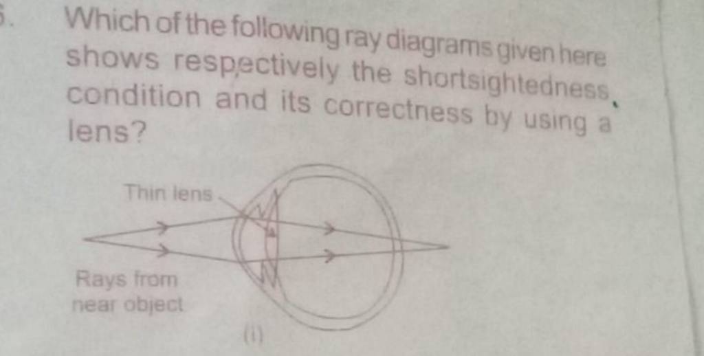 Which of the following ray diagrams given here shows respectively the sho..