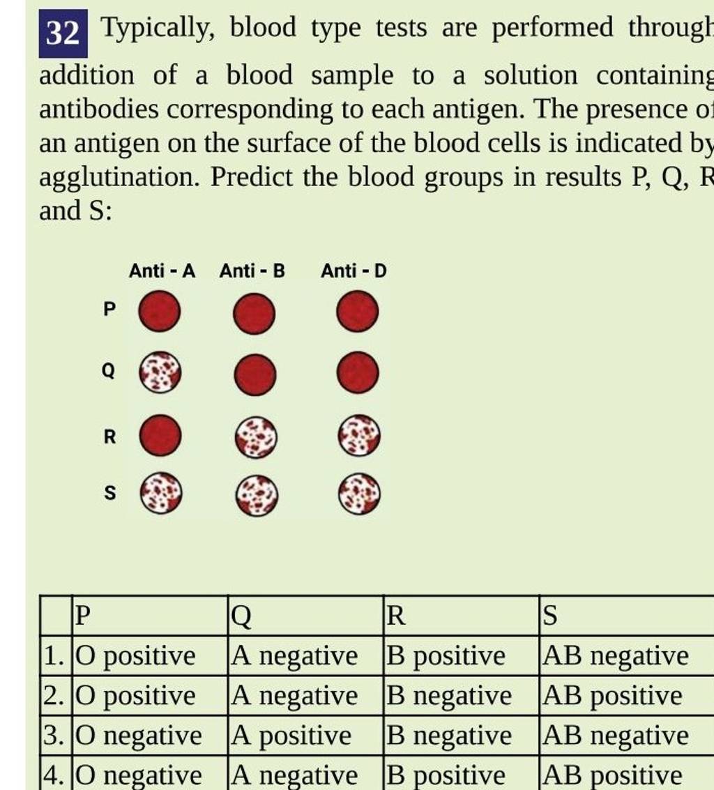 32 Typically, blood type tests are performed through addition of a blood