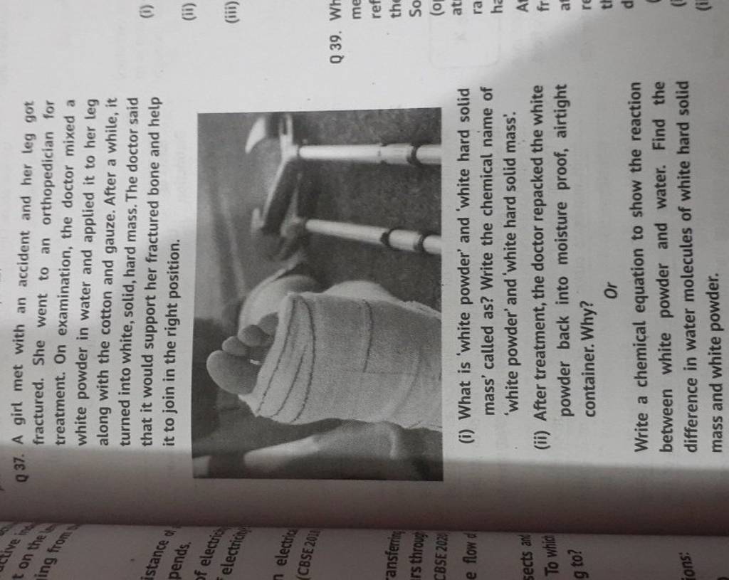 Q37. A girl met with an accident and her leg got fractured. She went to a..