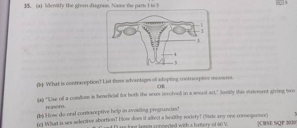 35 A Identify The Given Diagram Name The Parts 1 To 5 B What Is Con