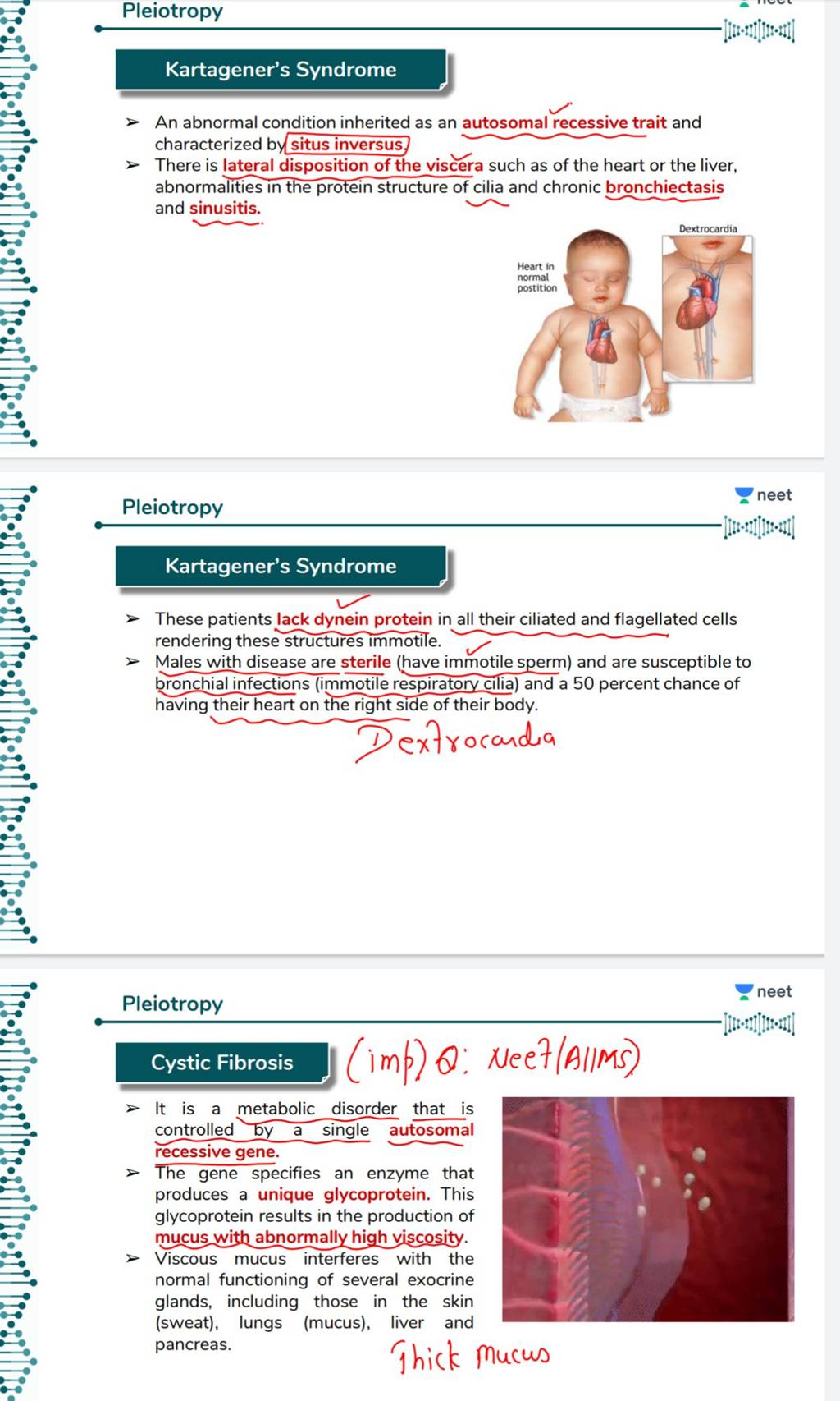 PleiotropyKartagener's Syndrome> An abnormal condition inherited as an
