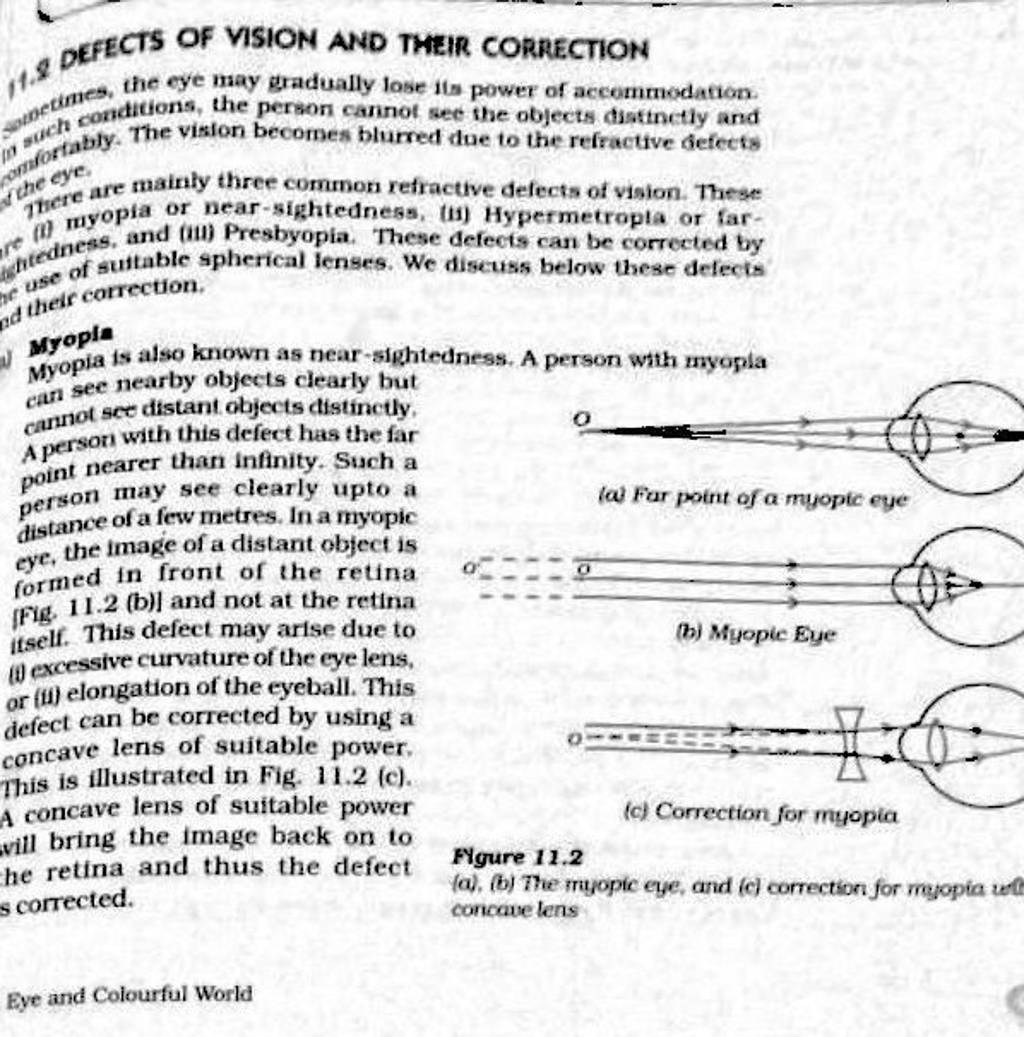 1-2-defects-of-vision-and-their-correction-of-elines-the-eye-may-gradua