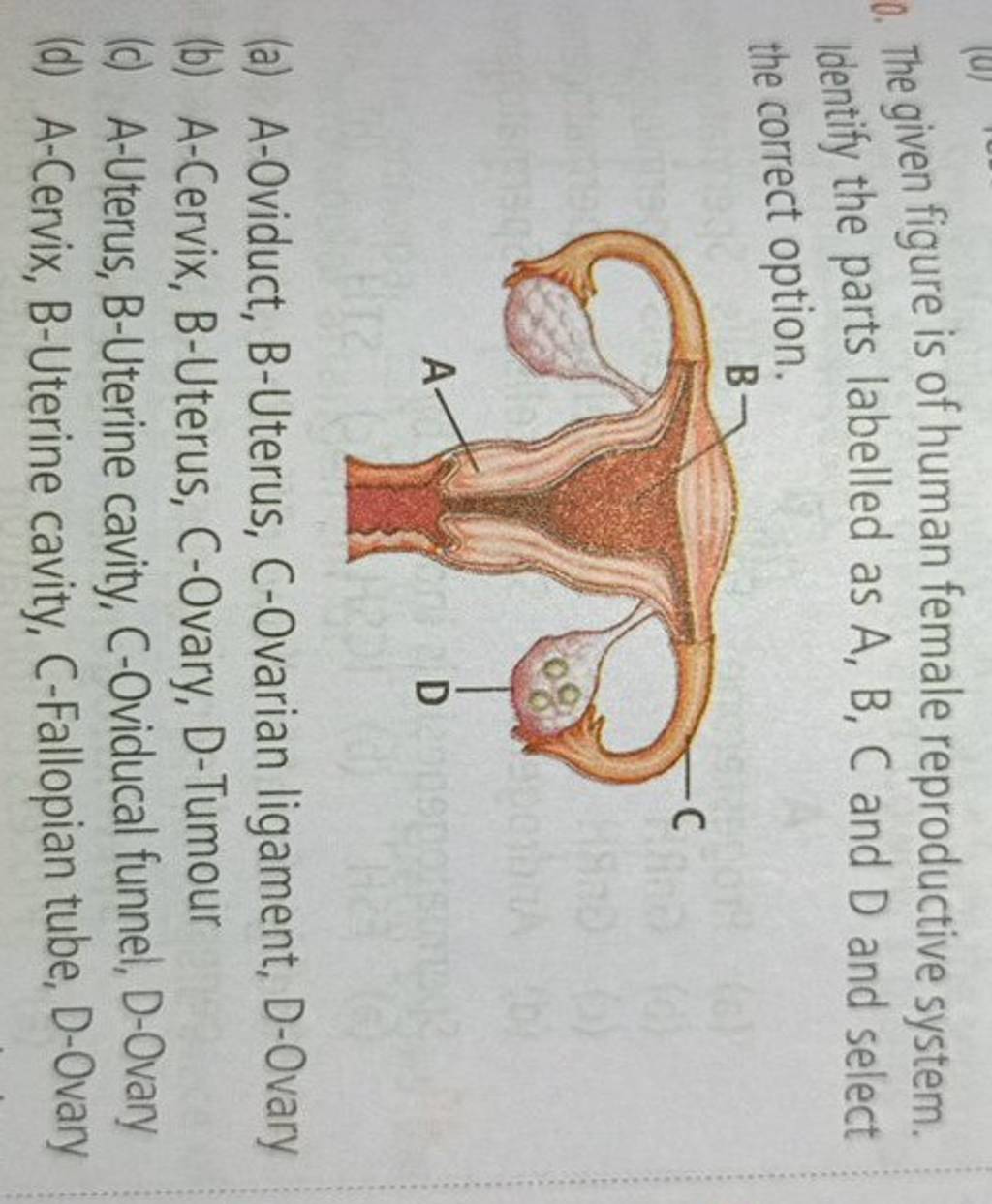 The given figure is of human female reproductive system. identify the par..