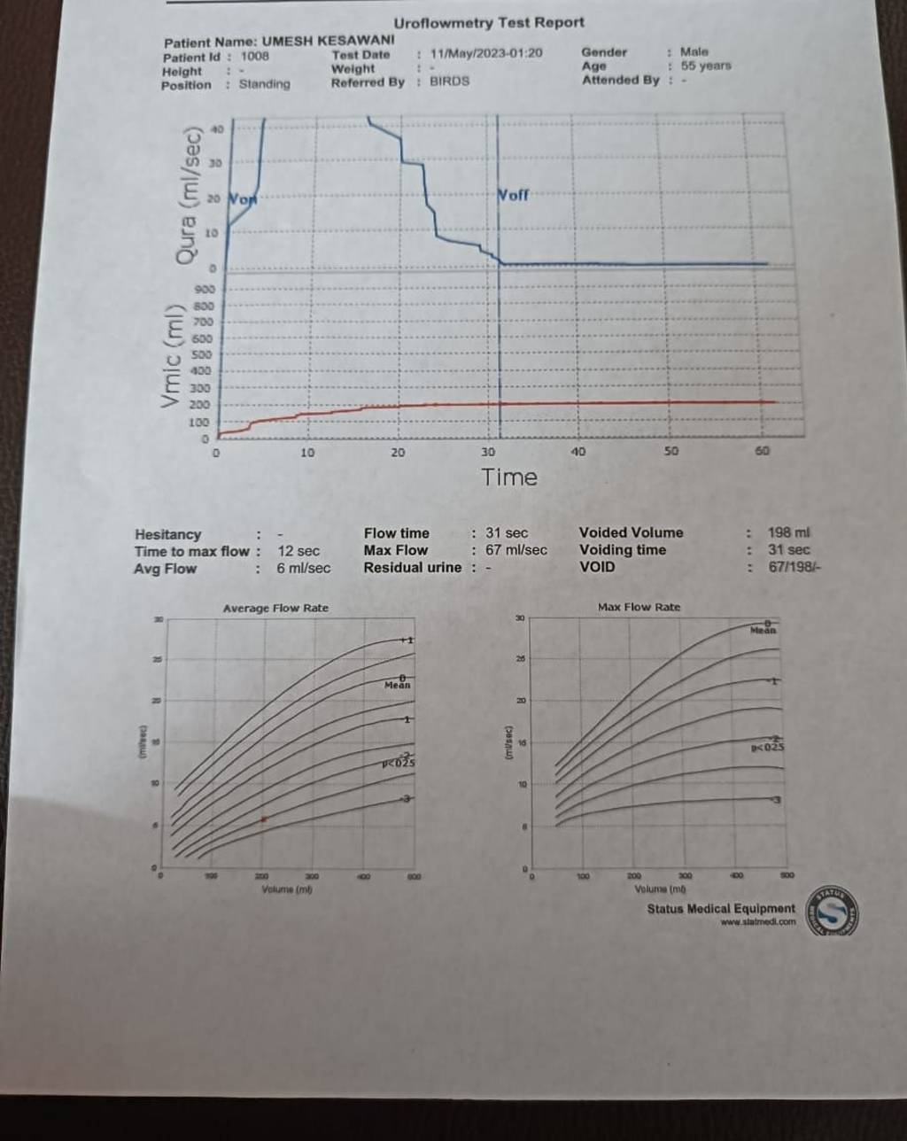 Uroflowmetry Test Report Patient Name: UMESH KESAWANI Patient ld : 1008 T..