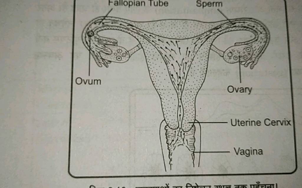 Ovum Fallopian Tube Sperm Ovary Uterine Cervix Vagina of fotar PE PERELL..