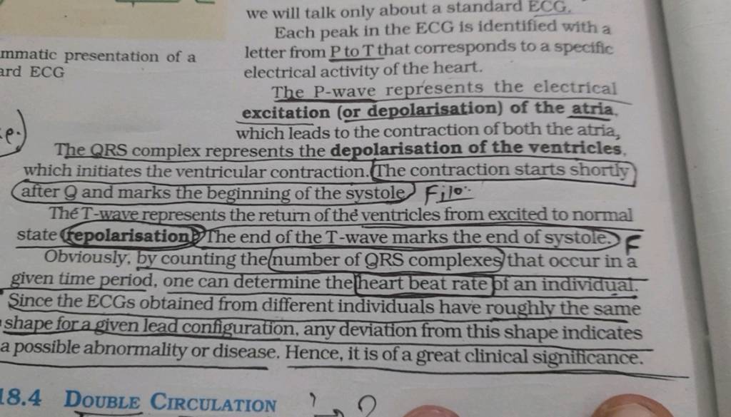 we-will-talk-only-about-a-standard-ecg-each-peak-in-the-ecg-is-identifie